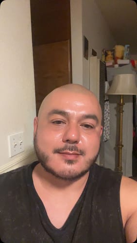 Customer photo review of Cosmic Collagen Beauty Complex - 64,000MCG - Illuminate Your Radiance!