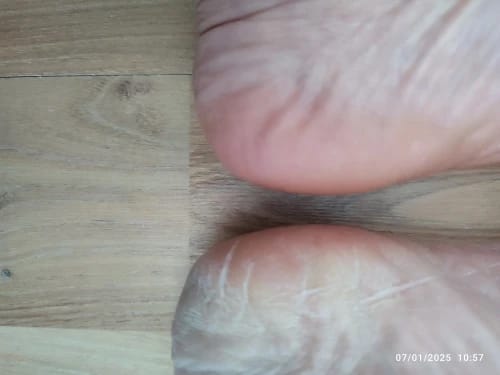 Customer photo review of Selyemlux - Bőrsimító 2.0