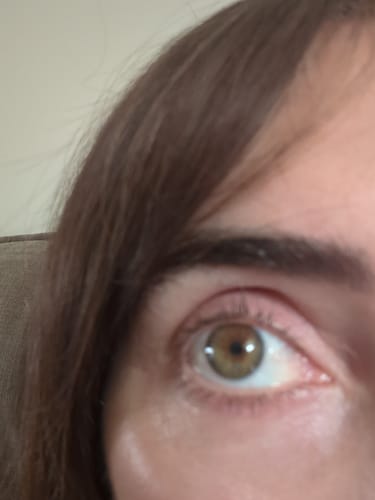 Customer photo review of KosmaLash® | Sérum Crecimiento & Anticaída