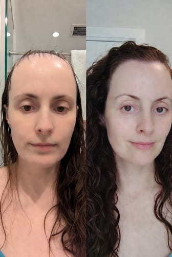Customer photo review of Postpartum Hair Loss Treatment [Spray, Serum, Mask & More]