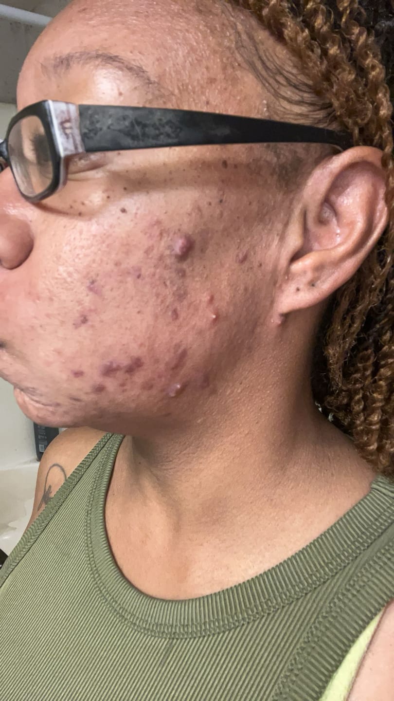 Customer photo review of Duo Skincare Bundle