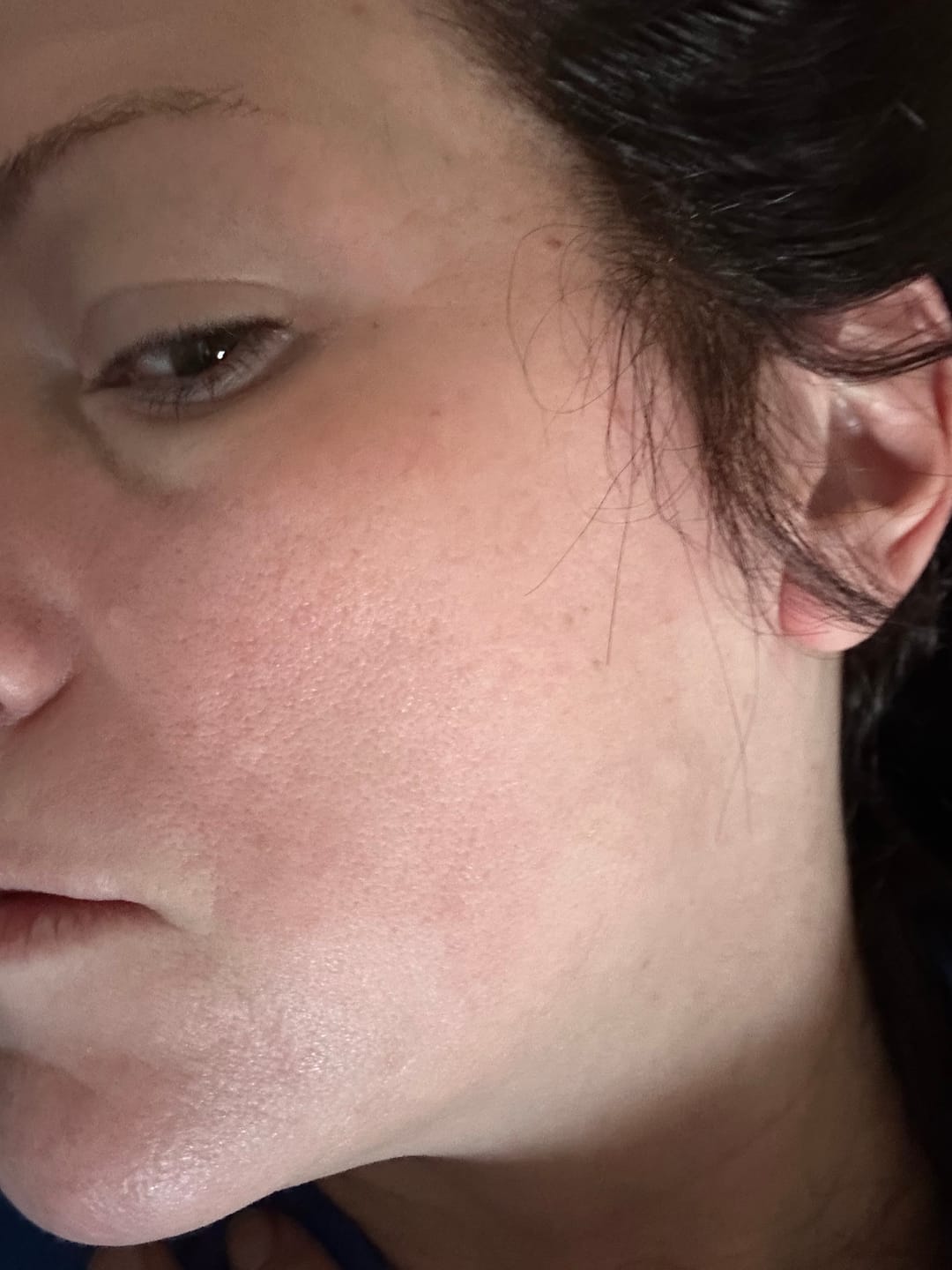 Customer photo review of VEAUTY Dot & Aqualis Activator