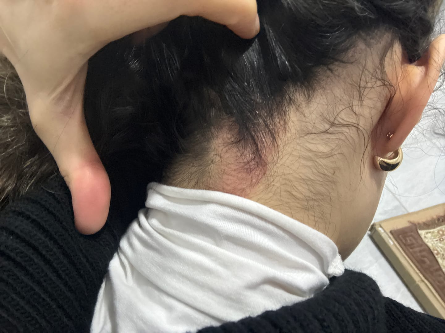 Customer photo review of Remedium SOS Onarıcı Bakım Kremi