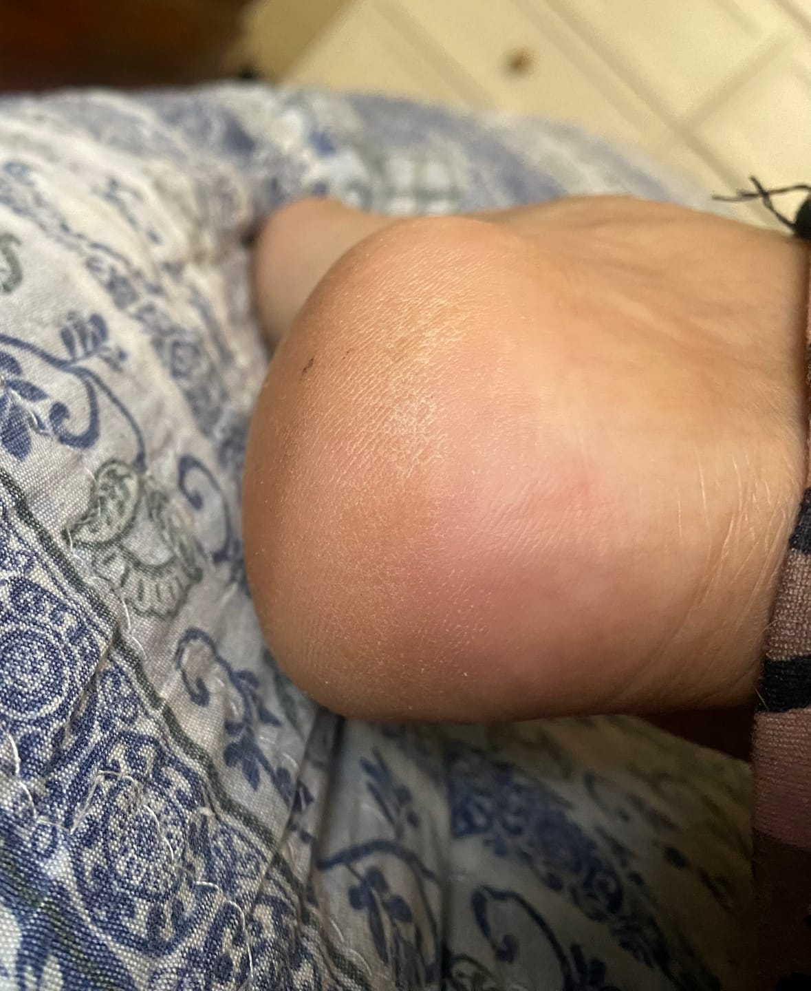 Customer photo review of Crema Pies Suaves Siempre – Urea 40%