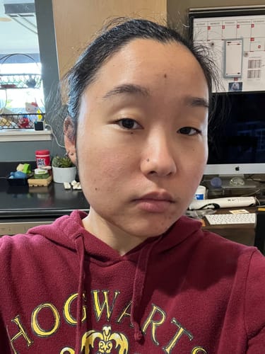 A close-up of the reviewer's face, showing their skin texture before using the Grass Fed Tallow & Honey Balm.