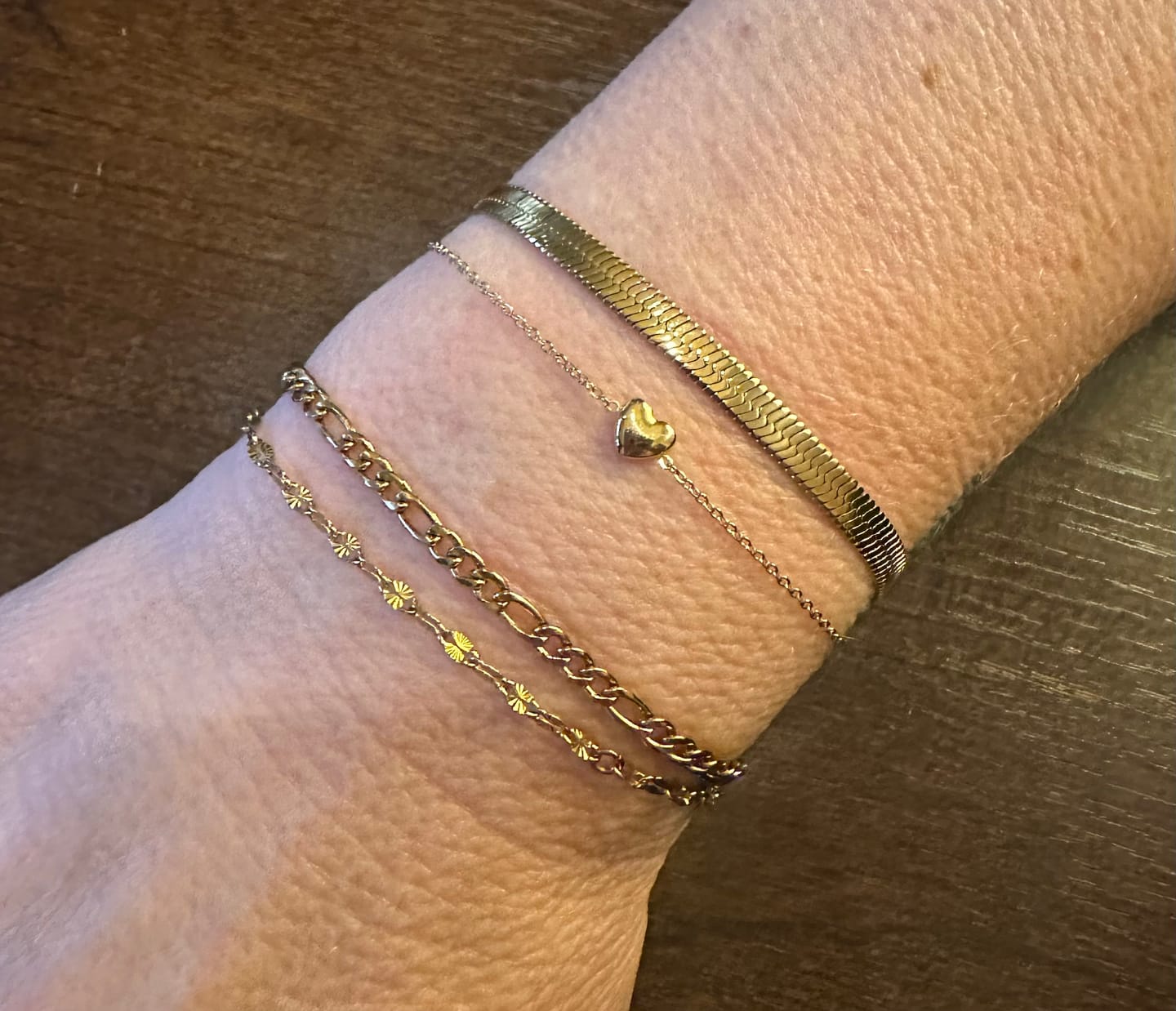 Customer photo review of Essentials Bracelet