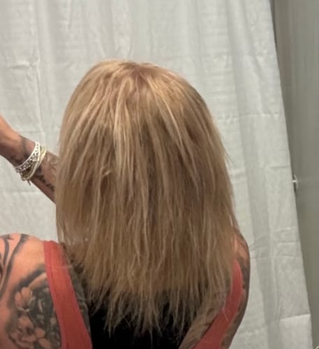 Customer photo review of Hair Loss Prevention Kit