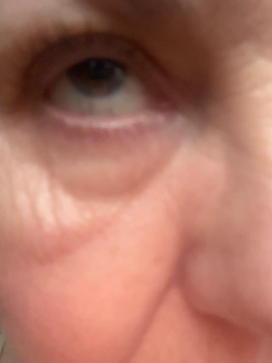 Customer photo review of Obagi ELASTIderm Eye Cream (15g)