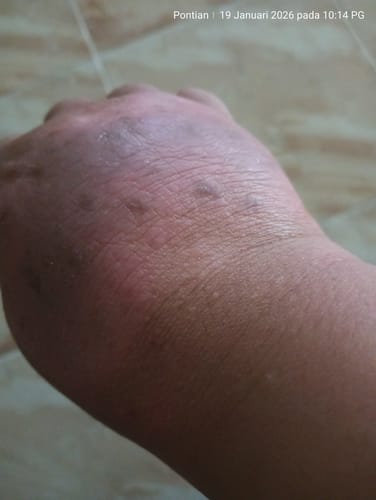 Customer photo review of Jolicare Cream