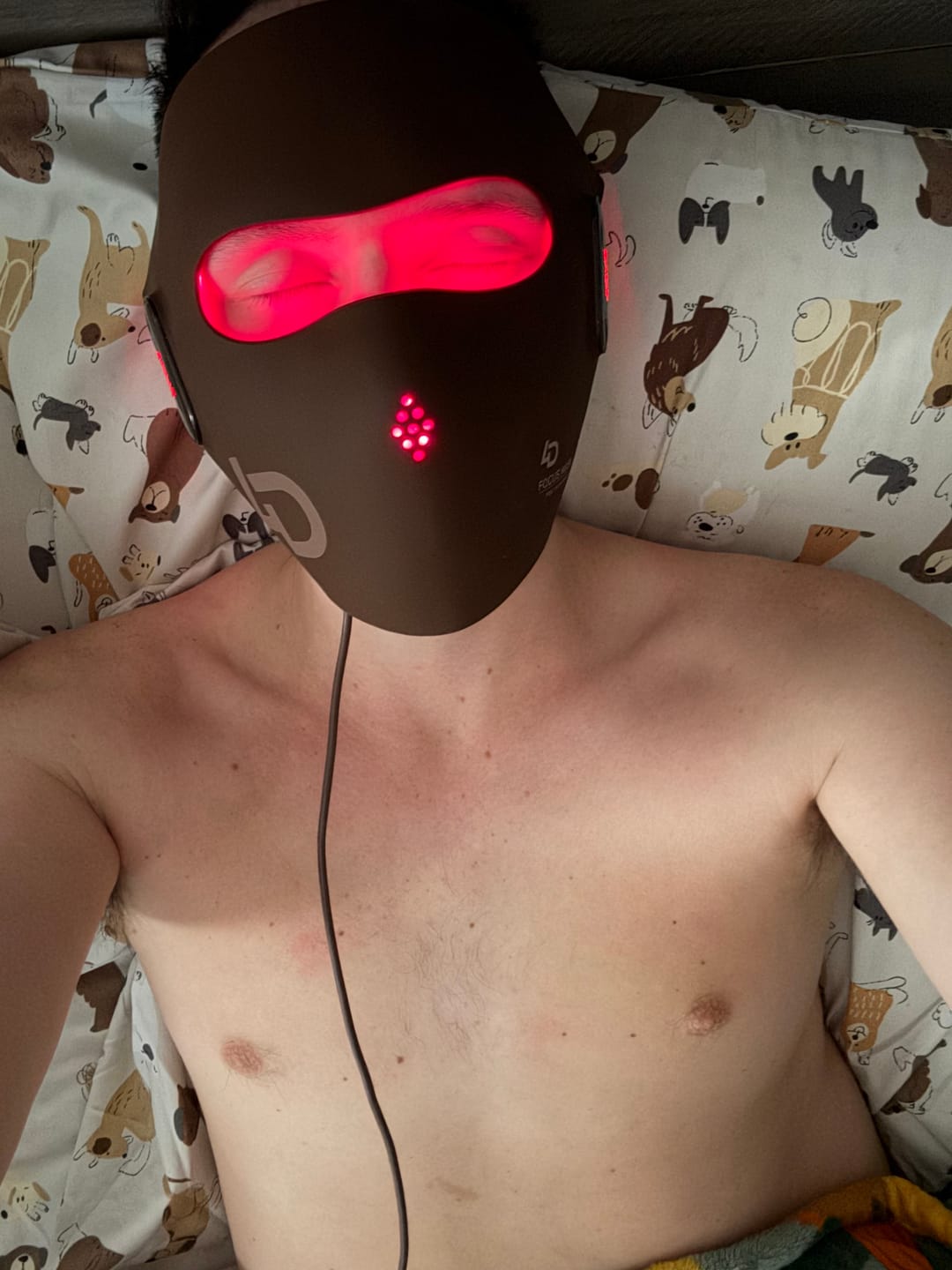 Customer photo review of JOVS 4D Laser Light Therapy Mask