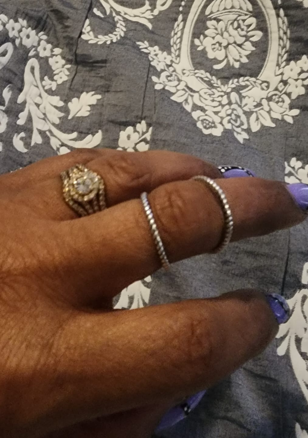 Customer photo review of Splint Knuckle Ring Sterling Silver