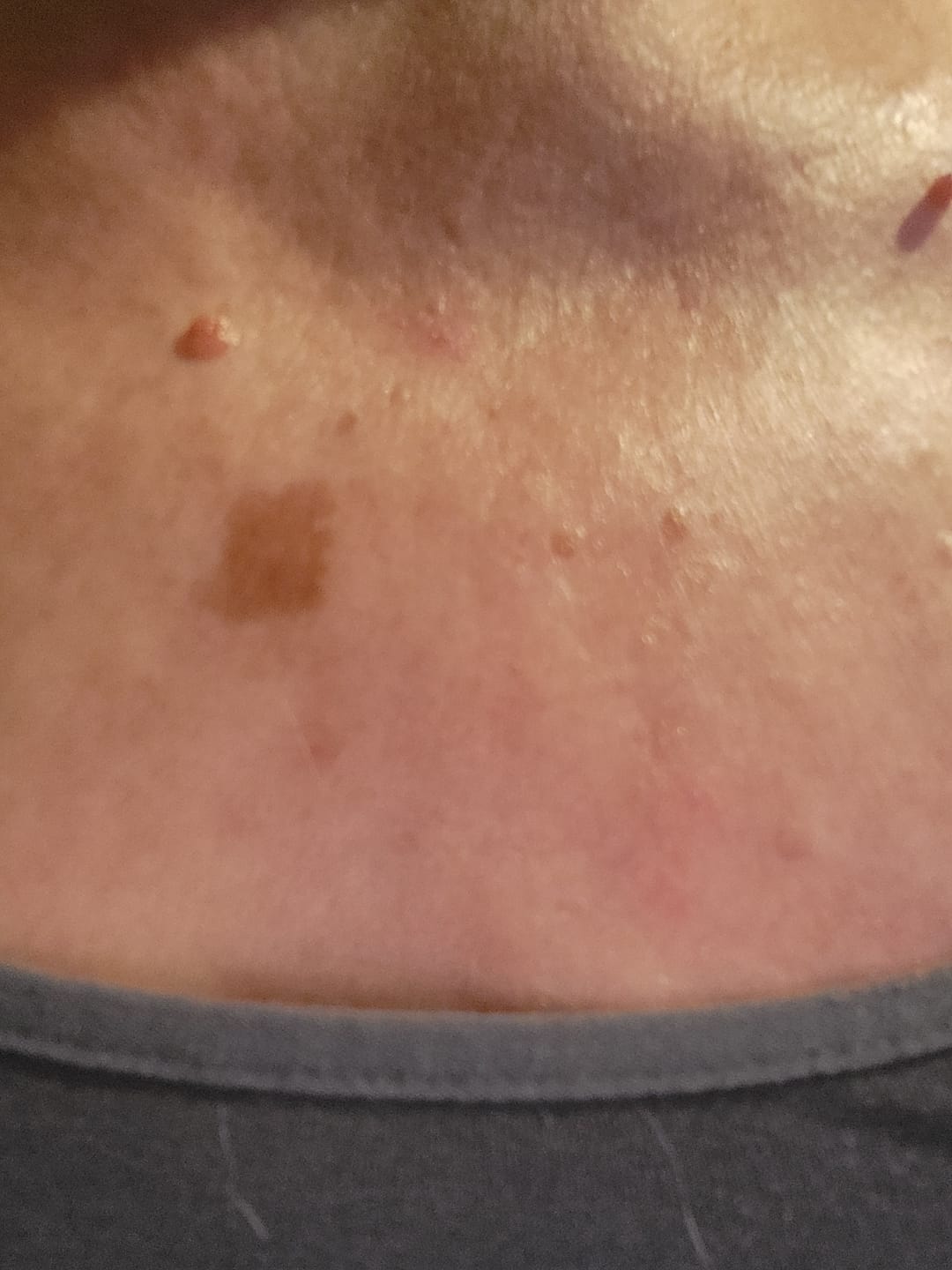 Customer photo review of Goda® Silk Body Oil