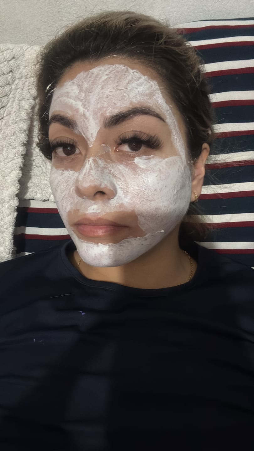 Customer photo review of Mascarilla de Arcilla con 3 Ácidos para Limpieza Profunda de Poros