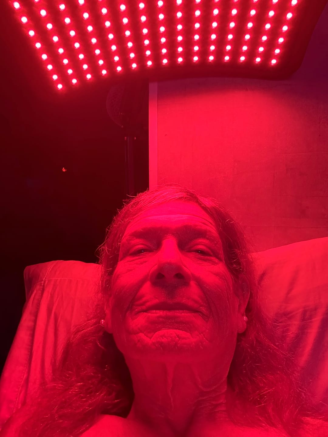 Customer photo review of Red Light Therapy Device