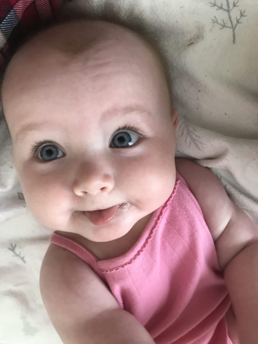Customer photo review of Beezema Eczema Cream