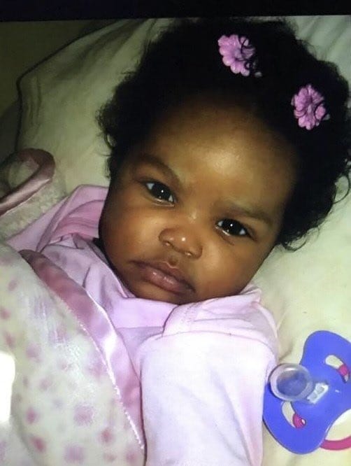 Customer photo review of Beezema Eczema Cream