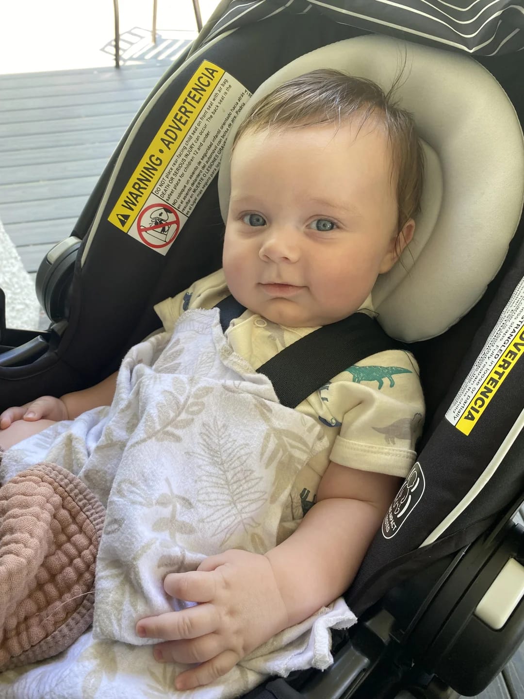 Customer photo review of Beezema Eczema Cream