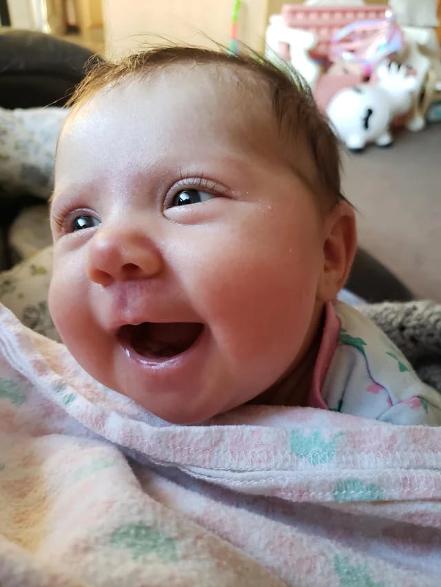 Customer photo review of Beezema Eczema Cream