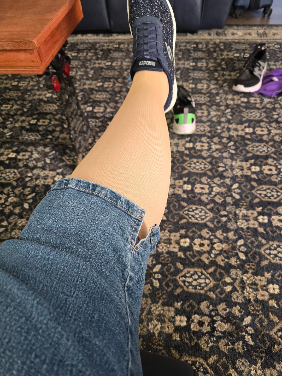 Customer photo review of The Step by Step Guide To Transforming Your Leg Health