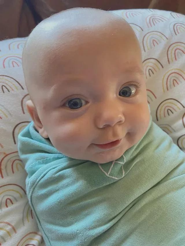 Customer photo review of Beezema Eczema Cream