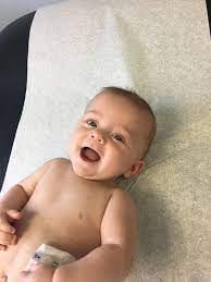 Customer photo review of Beezema Eczema Cream