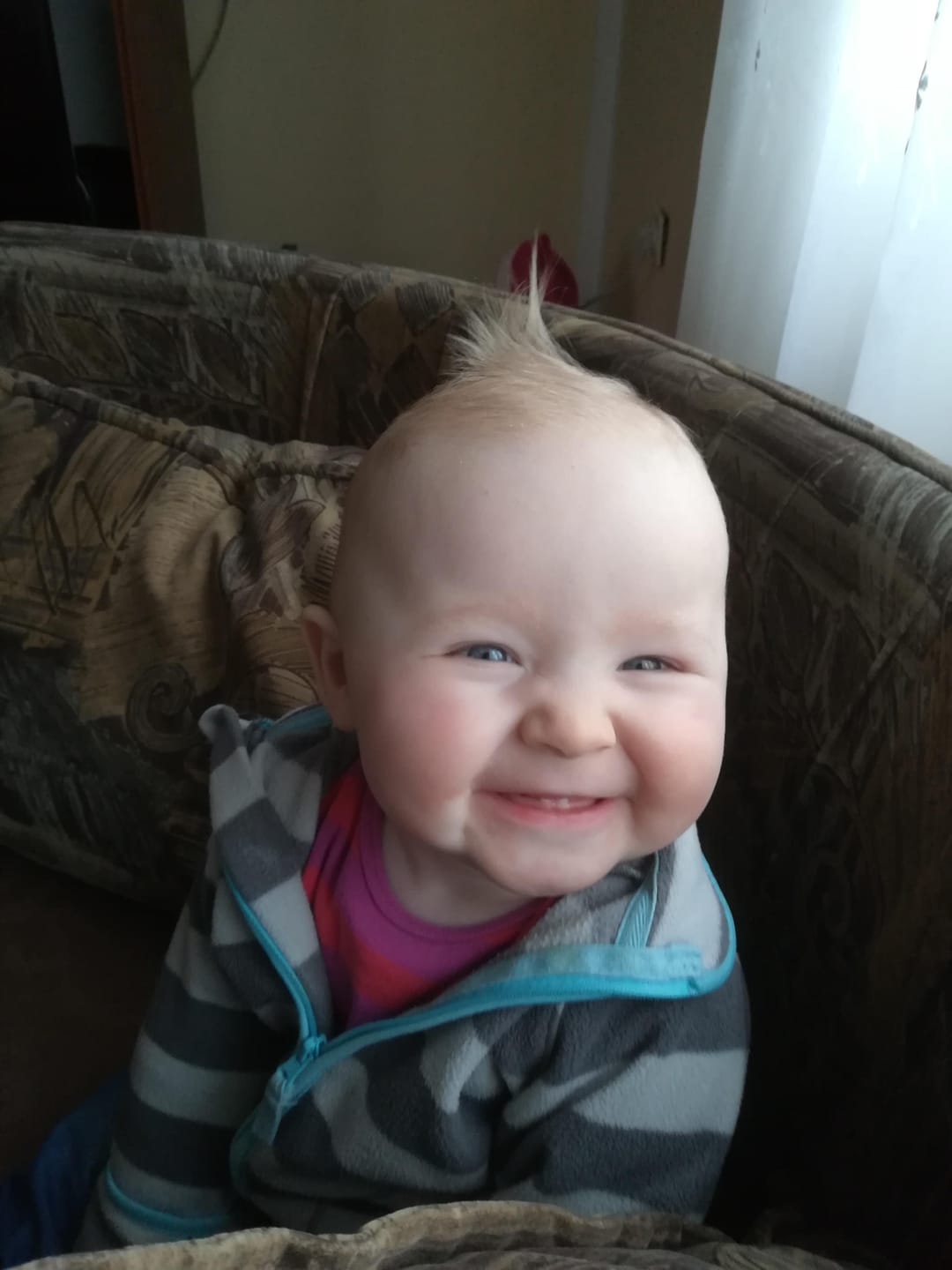 Customer photo review of Beezema Eczema Cream