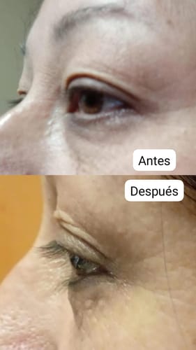Customer photo review of Suero para pestañas y cejas