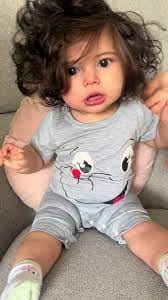 Customer photo review of Beezema Eczema Cream