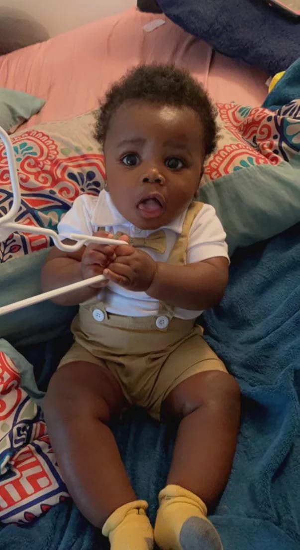 Customer photo review of Beezema Eczema Cream