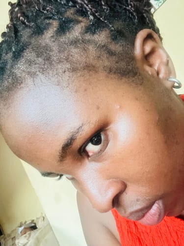 Customer photo review of Minoxidil High Strength (5%) FOAM, 3x60ml pack