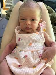 Customer photo review of Beezema Eczema Cream