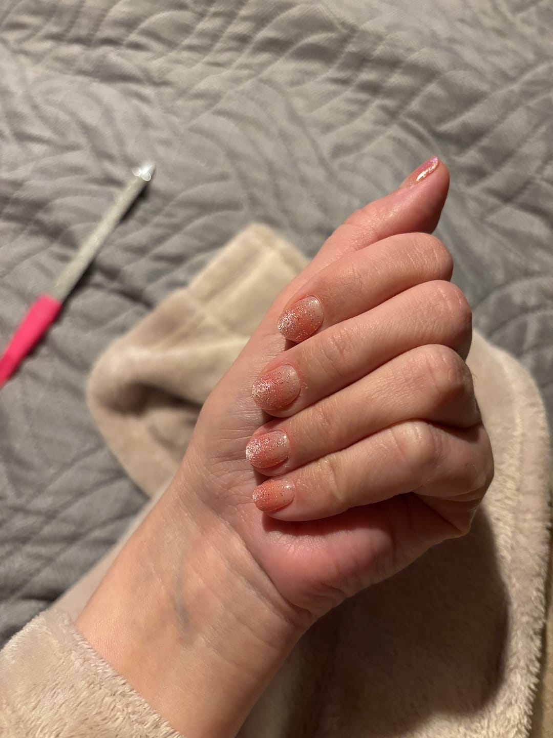Customer photo review of N Beginning Jel Tırnak 30 Adet, 2 Kullanım