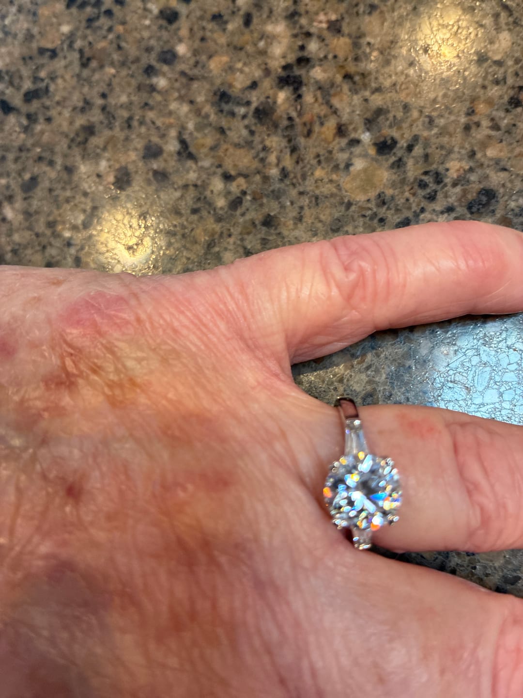 Customer photo review of Three Stone Round Moissanite Tapered Baguette Engagement Ring