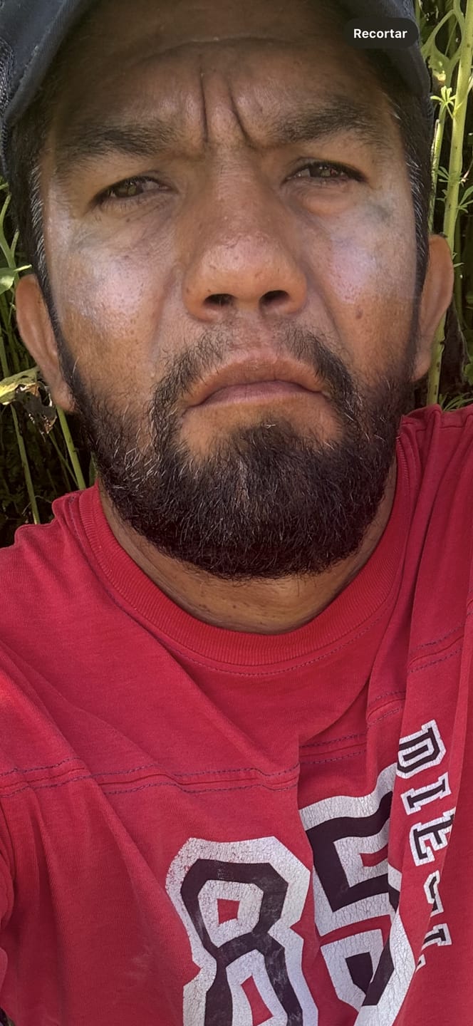 Customer photo review of Minoxidil al 20% -Espuma