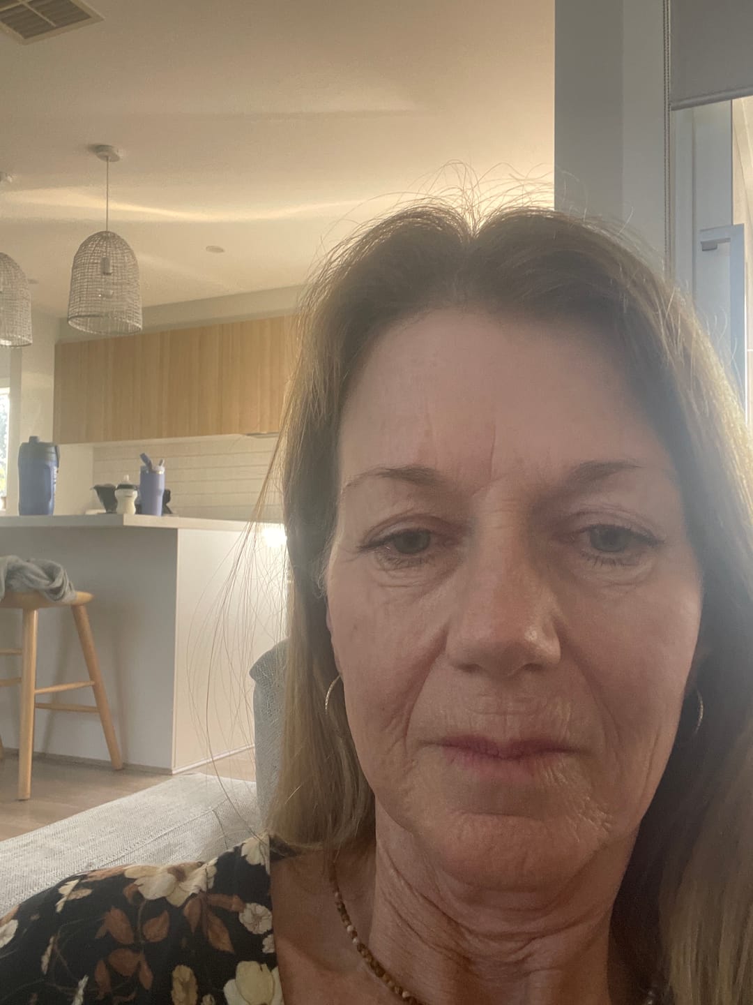 Customer photo review of Extra Sensitive SPF50+ Organic Mineral Zinc Sunscreen - Fragrance Free