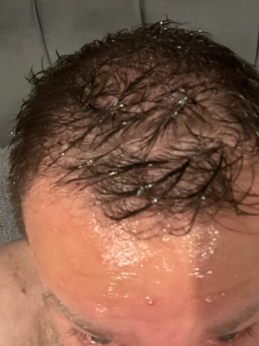 Customer photo review of Seb Natural Calming Serum