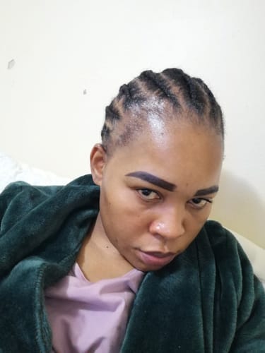 Customer photo review of Minoxidil High Strength (5%) SOLUTION, 3x60ml pack