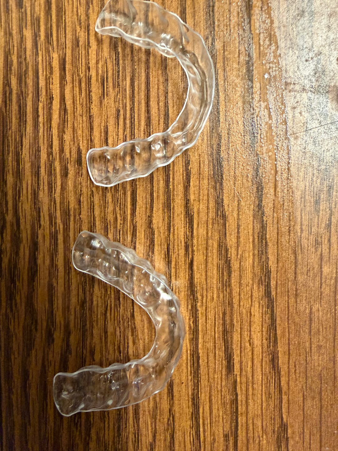 Customer photo review of Premium Upper and Lower Retainer Set