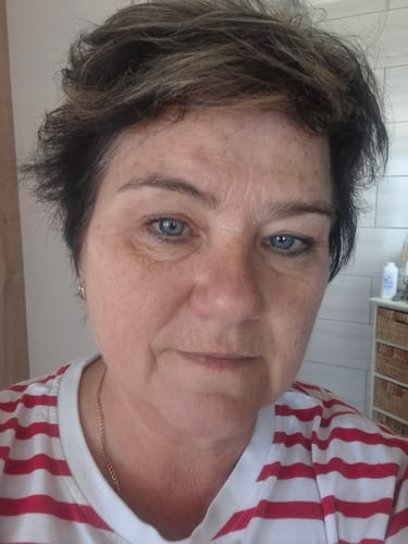 Customer photo review of The Glo Radiance Eye Cream