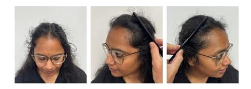 Customer photo review of Rosemary Elixir - 100% Natural Hair Loss Solution