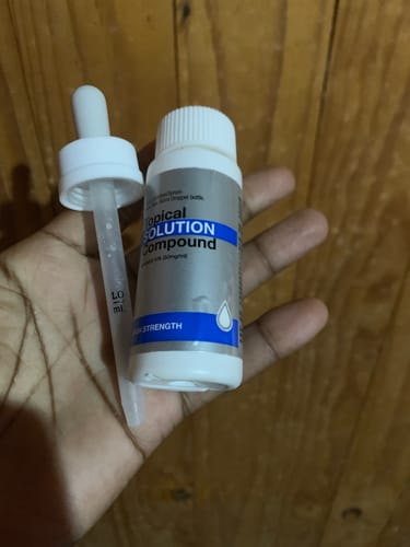 Customer photo review of Minoxidil High Strength (5%) SOLUTION, 3x60ml pack