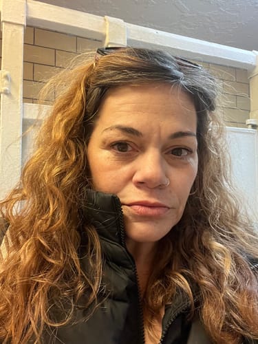 Customer photo review of WrinkleFix: Unlimited Toxins Membership