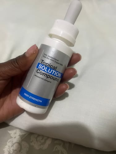 Customer photo review of Minoxidil 5% Solution, 1 Pack 60ml