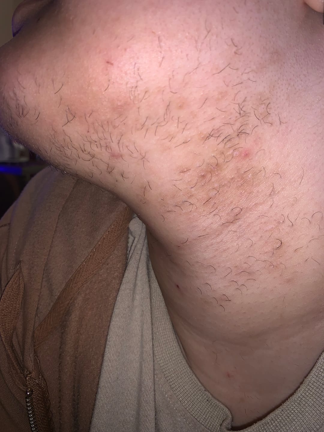 Customer photo review of Hair Reducing Fade Oil - Slows Growth, Thins, and Reduces Hair Naturally