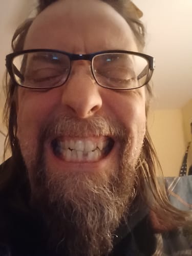 Customer photo review of Mouthology Toothpaste (1 pack)