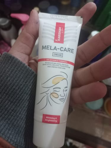Reviewer holding the Mela-Care Cream tube, which is part of the Pigmentation Bundle.
