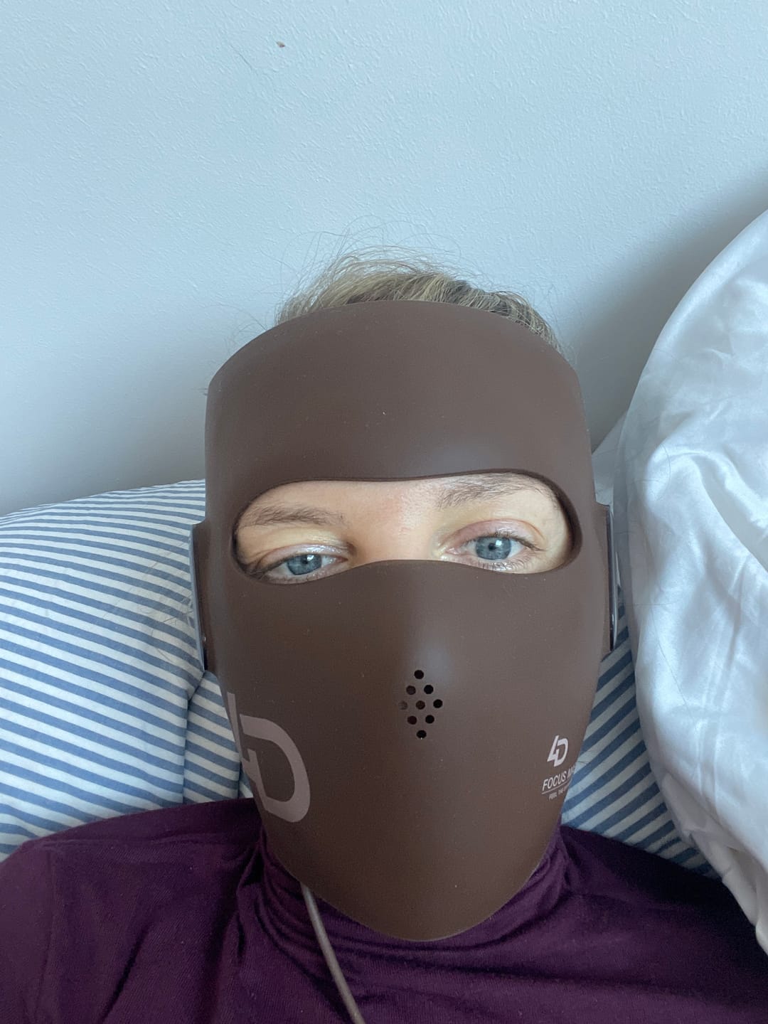 Customer photo review of JOVS 4D Laser Light Therapy Mask