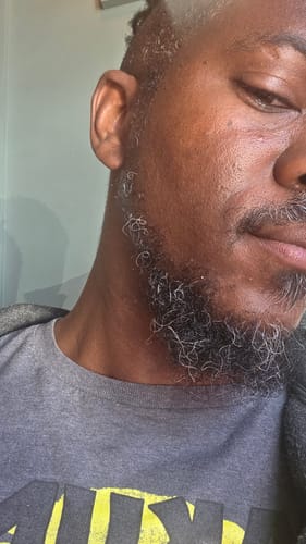 Customer photo review of New Complete Beard Care Kit