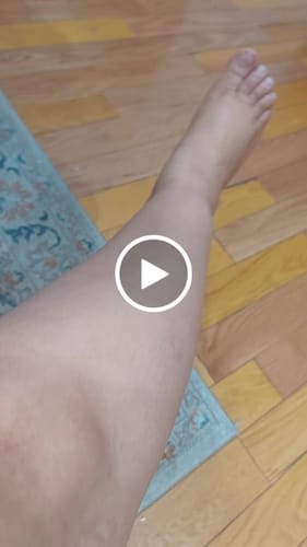 Customer video review of Fair & White So White Stubborn Spots and Body