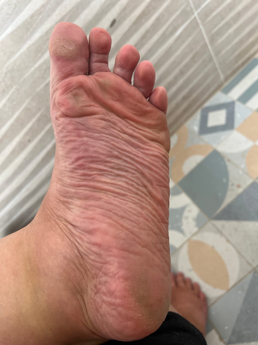 Customer photo review of Crema Pies Suaves Siempre – Urea 40%